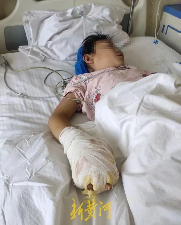 热水烫、殴打……女童遭继母虐待致残,其父称绝不和解 热水烫、殴打……女童遭继母虐待致残,其父称绝不和解